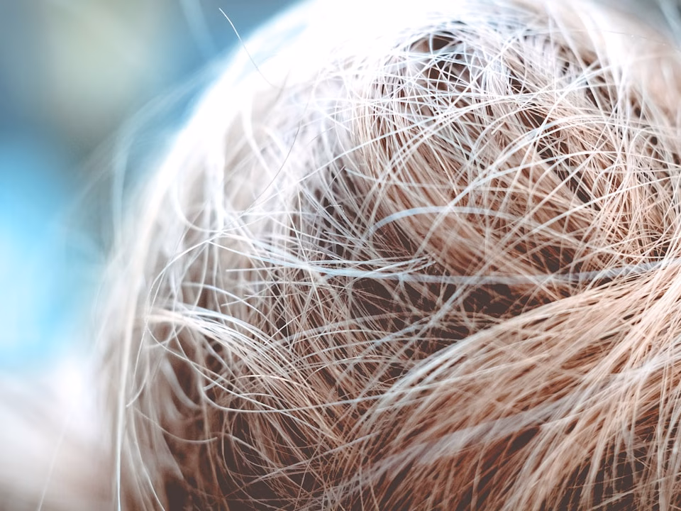 dry scalp and dandruff treatment