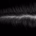 best scalp treatment for psoriasis