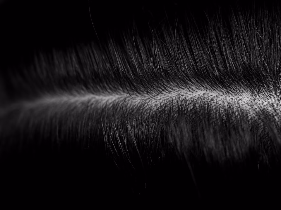 best scalp treatment for psoriasis